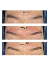 ベリル 金町店(Beryl)/wax後の赤み