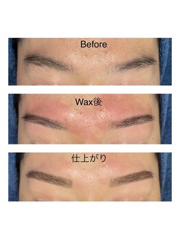 ベリル 金町店(Beryl)/wax後の赤み