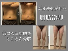 モンセルヴィ(monselvi)