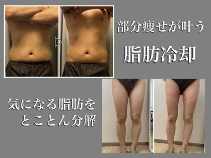 モンセルヴィ(monselvi)の写真