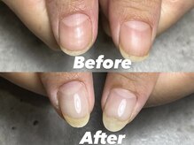 結(Yui)/自爪育成 Before→After