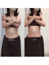 ジョワイユ(Joyeux)/腸の位置でお腹は変わる