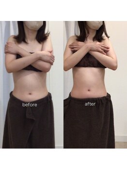 ジョワイユ(Joyeux)/腸の位置でお腹は変わる