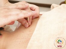 ウィズ(Wiz)/フェイスラインの変化