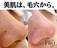 アンビワン(Anbione.)