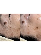 エミナル バイ ニコドット(Eminal by nico.)/乾燥小じわ