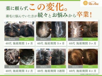 リアン 目黒(Re-Ane)の写真