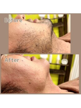 ココ(KoKo)/men'sおひげ