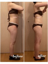 アンフィニ(infini)/短期集中全身コース5回（2ヶ月）