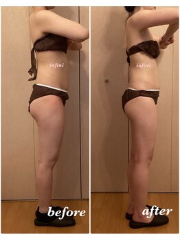 アンフィニ(infini)/短期集中全身コース5回(2ヶ月)