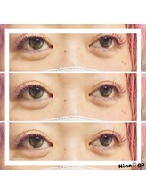 ナイン ゴー(Nine go)/バインドロック