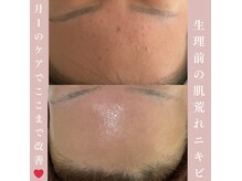 ファミーユ(famille)の雰囲気（ハーブで皮膚深部にアプローチ！繰り返す肌荒れを丸ごと解決）