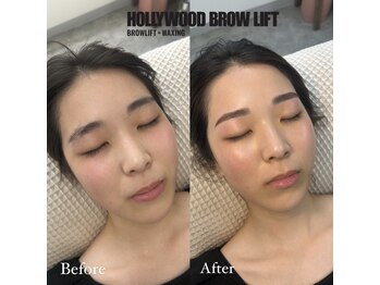 アリー(Arie)/眉毛とお顔の同時施術！