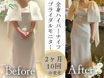 スリムプロ 天王寺店(Slimpro)/ブライダルエステ☆