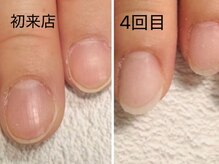 グレースレディ 神戸北店/