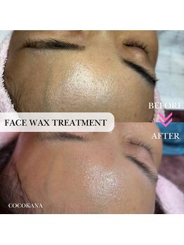 ココカナ(COCOKANA)/フェイスワックストリートメント