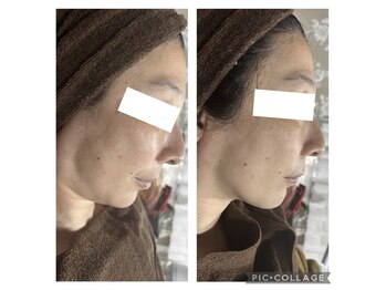 オアジスパ(Oasi Spa)/