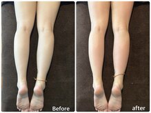 ボヌールデソワ(Bonheur de Soi)/痩身エステ