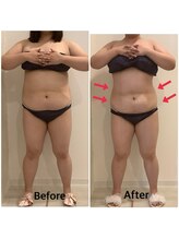 スペチアーレ 夙川/要らない脂肪冷却はトイレに流す