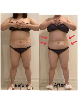 スペチアーレ 夙川/要らない脂肪冷却はトイレに流す