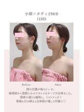 トゥインクル 麻布(twinkle)/港区/南麻布/白金高輪/小顔矯正