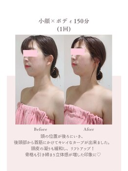 トゥインクル 麻布(twinkle)/港区/南麻布/白金高輪/小顔矯正