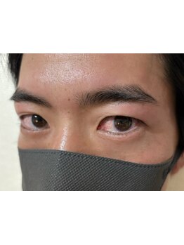 メンズフェイシャル