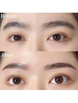 レピア 郡山駅前店/韓国式LEPIA Before&After