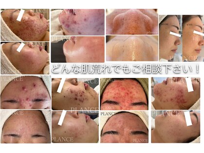 プランス 恵比寿店(PLANCE)の写真