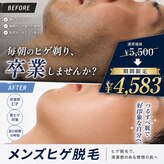 メンズエムボーテ 太田店(Men's M BEAUTE33)