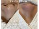 ボンセジュール(Bon sejour)の写真