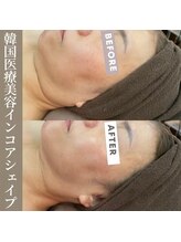 リラクゼーションサロン ラキ(laki)/インコアシェイプ