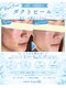 ルベル(Luvelle)の写真/「毛穴・ニキビ・くすみをまとめてケア。肌質改善ダクトピール」