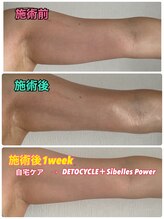 ルミネ(Lumine)/最強コラボ＋自宅ケアで夏対策♪