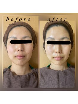 フェリーチェ(felice)/フェイシャルエステ