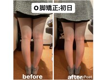 カワル整体 上通り院/【o脚矯正】