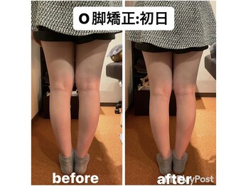 カワル整体 上通り院/【o脚矯正】