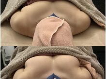 ベッピン(Beppin)の雰囲気（業界最新機器NRを使用してクーパー靱帯を鍛えて自分の脂肪増加！）
