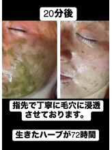 フーレスト アンド フリーリー(Fullest&Freely)/ハーブピール