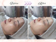 ソワナ(soina)の雰囲気（＜素肌をキレイにする＞豊富な美肌育成メニューで素肌美人に。）