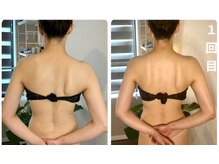 蒼(so)/肩甲骨はがし・肩甲骨矯正