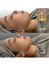 クレビア(CREBIA)/最先端脂肪分解はレモン一択！