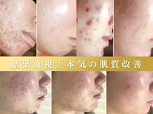 ホワイトアクア 成田店(WHITE AQUA)