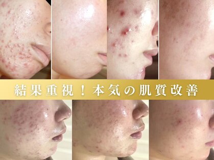 ホワイトアクア 成田店(WHITE AQUA)の写真