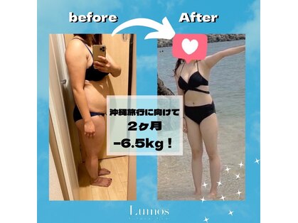 ルーモス(Lumos)の写真