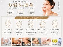 アウラ(AURA)