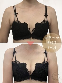 ヴェルナ(VELUNA)の写真/女性らしいデコルテと美胸ラインへ♪VELUNA人気の結果重視バスト体験90分★