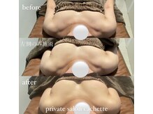 カシェット(cachette)/ミラクルバストプレミアム