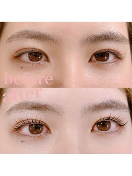 ジーニー(Genie)/