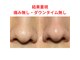 ロール(Rowl)の写真